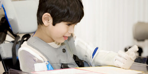 Cerebral Palsy – Symptoms and Management Options