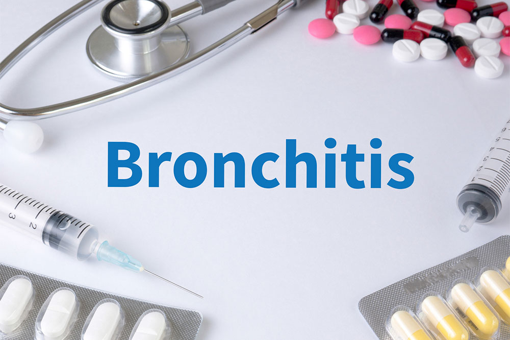 Bronchitis – Top Remedies and Management Options