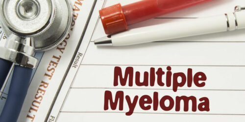 Dealing with multiple myeloma – Things you should know about
