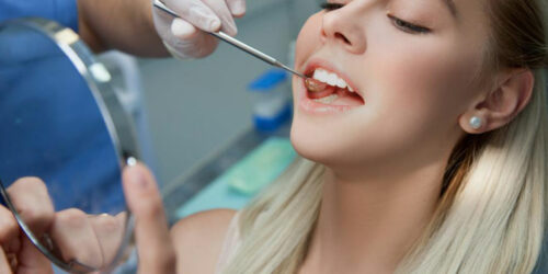 Dental insurance – Is it worth a bite?