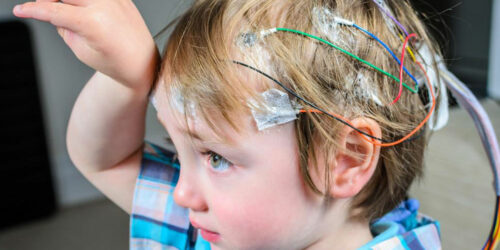 Here’s how you can help someone undergoing an epileptic seizure