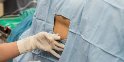 Percutaneous lumbar laser disc decompression – An overview