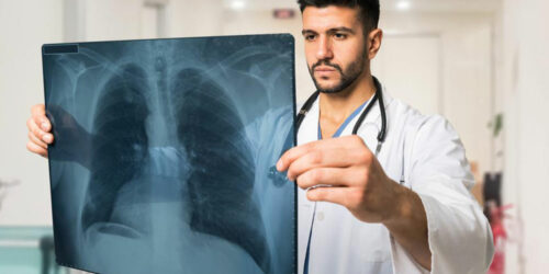 Respiratory disorders – an overview