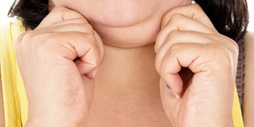 Struggling with a double chin? Here’s how you can get rid of it