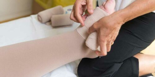 Swollen Legs – Causes and Remedies