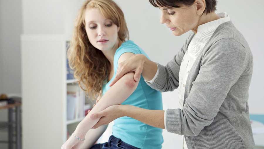 Severe Psoriasis – Treatment Options to Consider