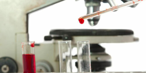 WBC count – Understanding the blood count