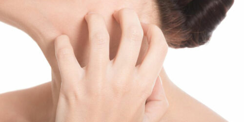 6 common types of eczema disorders you should know about