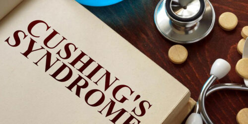 The symptoms of Cushing’s disease