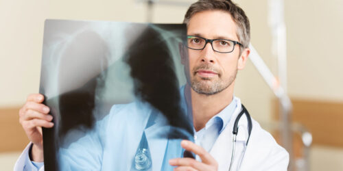 6 Factors to Consider When Choosing a Lung Cancer Hospital